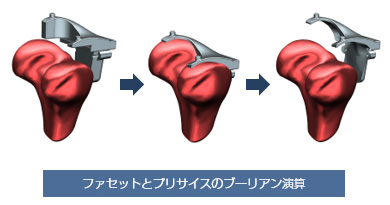 ファセットとプリサイスのブーリアン演算