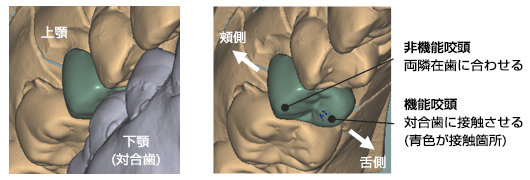 左：上顎 下顎(対合歯)右：頬側 舌側 非機能咬頭 両隣在歯 機能咬頭
対合歯に接触させる（青色が接触箇所）に合わせる