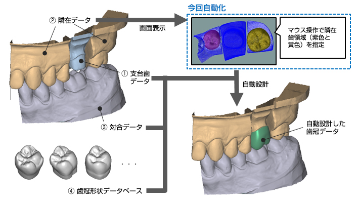 ①支台歯データ→自動設計→自動設計した歯冠データ②隣在データ→画面表示→今回自動化 マウス操作で隣在歯領域（紫色と黄色）を指定→自動設計→自動設計した歯冠データ③対合データ→自動設計→自動設計した歯冠データ④歯冠形状データベース→自動設計→自動設計した歯冠データ