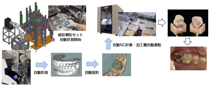 歯型模型セット自動計測開始→自動計測→自動設計→自動NC計算・加工機自動運転→