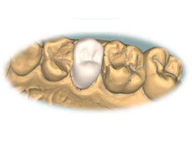 ダミーイメージ