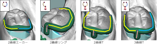 クラスプ