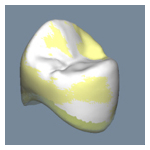 補綴物計測データ