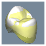 補綴物計測データ